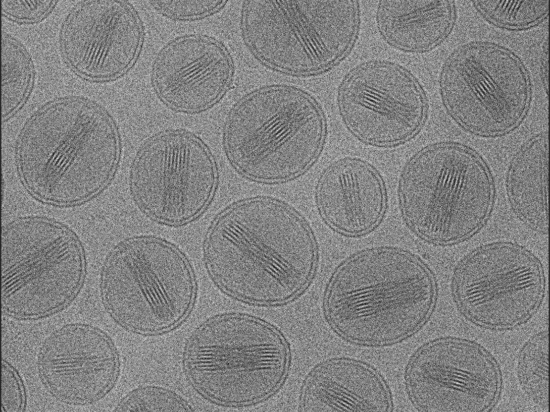 Liposomal Vitamin C Electron Microscopy (EM) imaging